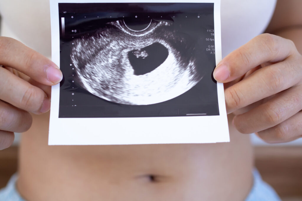 Trimestrul 1 de sarcina: morfologia fetală, somn, lucruri interzise, dureri de burtă, alte informații utile