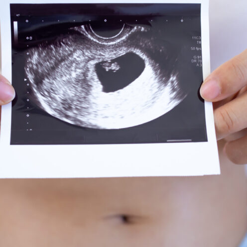 Trimestrul 1 de sarcina: morfologia fetală, somn, lucruri interzise, dureri de burtă, alte informații utile